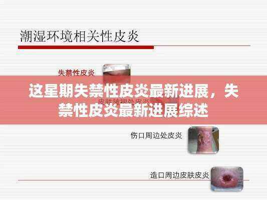 失禁性皮炎最新进展综述,本周最新研究成果概览