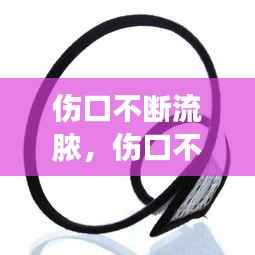 伤口不断流脓,伤口不断流脓水