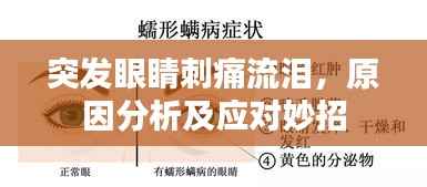 突发眼睛刺痛流泪,原因分析及应对妙招